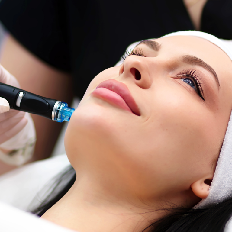 Hydrodermabrasion (2)