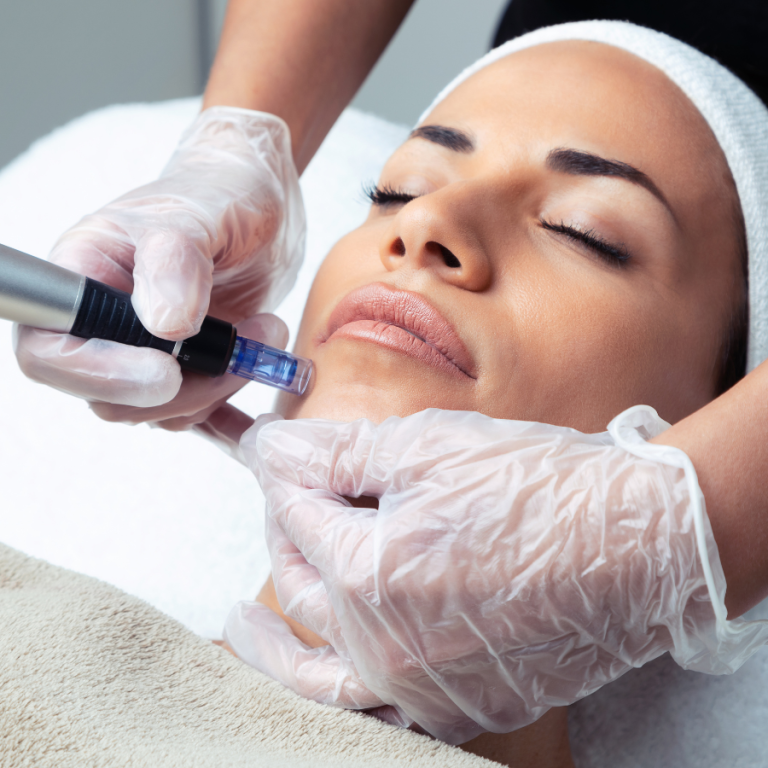 Hydrodermabrasion (6)
